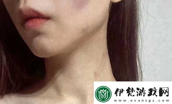 紅雅典娜LIYA死了嗎